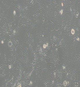 SW 1990人胰腺癌細胞(L15） 主圖