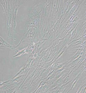 CCD-1095Sk人乳腺浸潤性導(dǎo)管癌旁皮膚細胞主圖